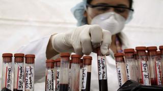 EE.UU.: Indiana declarará emergencia por epidemia de VIH