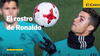 Cristiano Ronaldo: el rostro golpeado del crack luso [VIDEO]