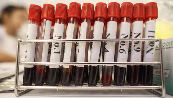 Empresa busca detectar el cáncer a través de pruebas de sangre