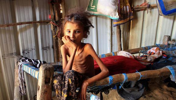 La niña yemení de 10 años llamada Ahmadia Abdo, que pesa diez kilos debido a la desnutrición aguda, se sienta en su cama en un campamento para desplazados internos en la gobernación norteña de Hajjah, el 23 de enero de 2021. (Foto de ESSA AHMED / AFP).