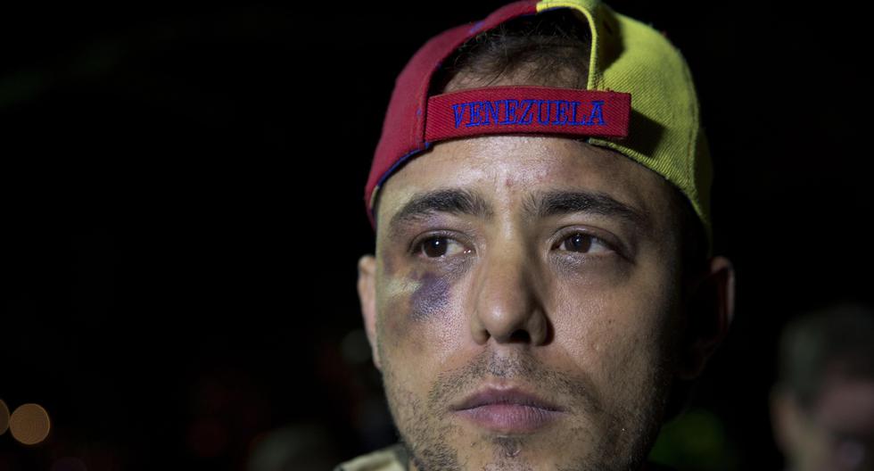 Medina fue privado de libertad el 29 de agosto de 2018 en la estación Plaza Venezuela del Metro de Caracas por funcionarios del Servicio Bolivariano de Inteligencia Nacional (Sebin), luego de que realizara un reportaje sobre la crisis hospitalaria del país. (AP)