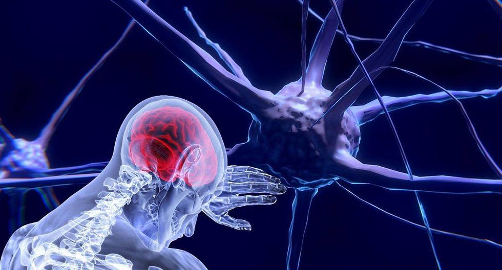Este tipo de cáncer es el más complejo ya que, al afectar al cerebro, sus síntomas pueden presentarse de forma abrupta y agresiva, y puede ser difícil de diagnosticar. (Foto: Pixabay)