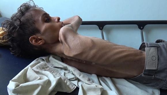 Yemen: Al menos 85.000 niños muertos por hambre y enfermedades durante la guerra. (Foto: AFP)