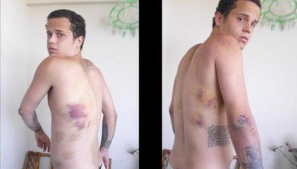 El desgarrador testimonio de un joven torturado en Venezuela