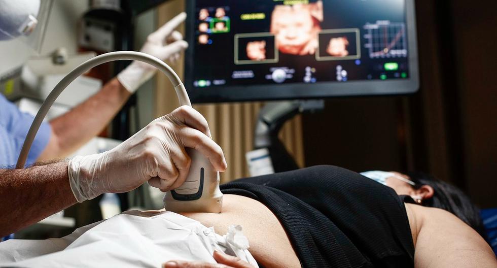 Mother’s Day: Pregnancy Survey Now More Accurate and Intuitive Thanks to Artificial Intelligence |  Spain |  Mexico |  USA |  2D to 7D Ultrasound |  Technology