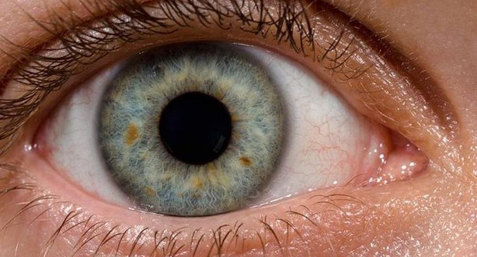 El cáncer de ojo es una enfermedad que avanza rápidamente. (Foto: Diusión)