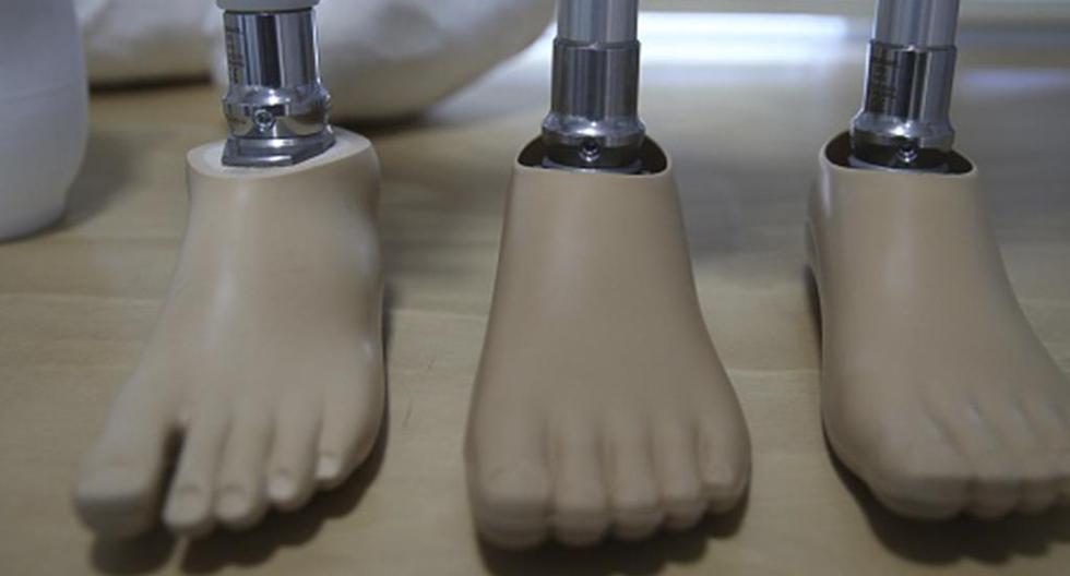 Crean un laboratorio para crear prótesis con impresoras 3D que mejorará, a través de sus artículos personalizados, el proceso de curación de los pacientes. (Foto: Getty Images)