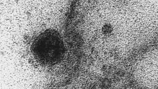 Coronavirus | Captan el preciso momento en que el virus infecta una célula | FOTOS