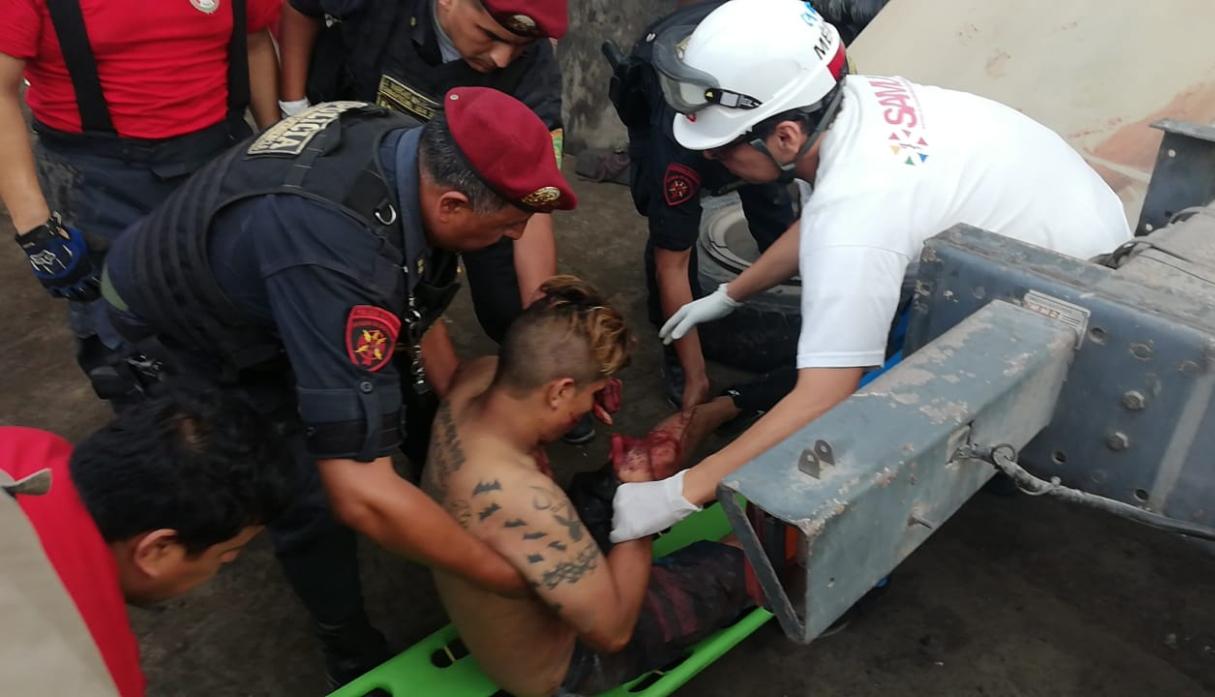 Personal de la Policía y los Bomberos atendieron al presunto feminicida que intentó quitarse la vida en un hotel. (Foto: Kelvin García / El Comercio)