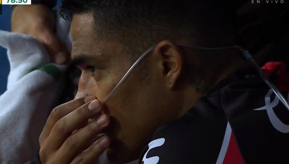 Anderson Santamaría recibió oxígeno luego de salir del campo por golpe en la nariz | VIDEO. (Foto: TUDN)
