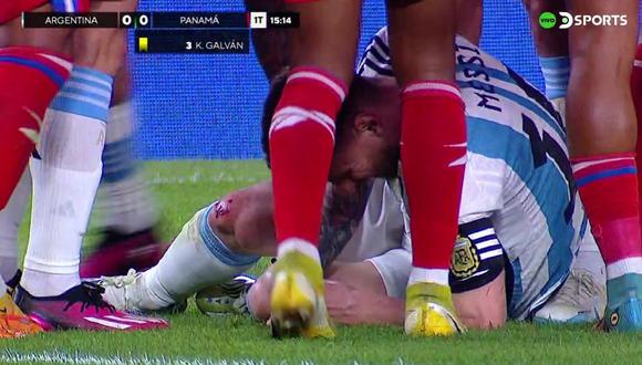 Lionel Messi terminó con una cicatriz en su rodilla derecha.